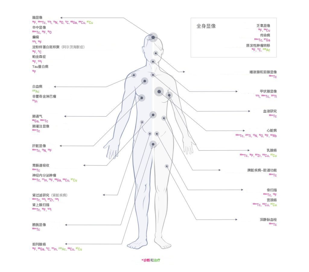 放射性核素可以用于全身显像，在医学上诊断和治疗各种疾病 | IBA - Radio Pharma Solutions